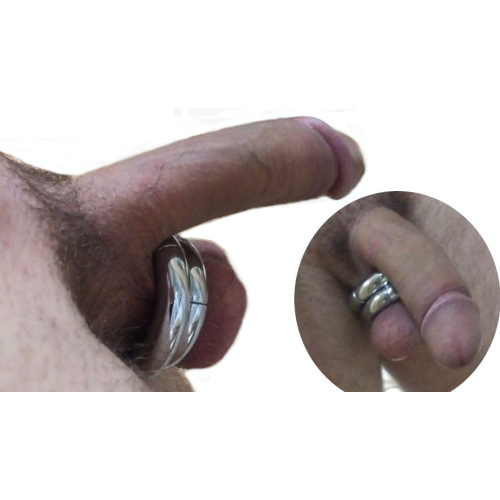Mágneses erekciós gyűrű